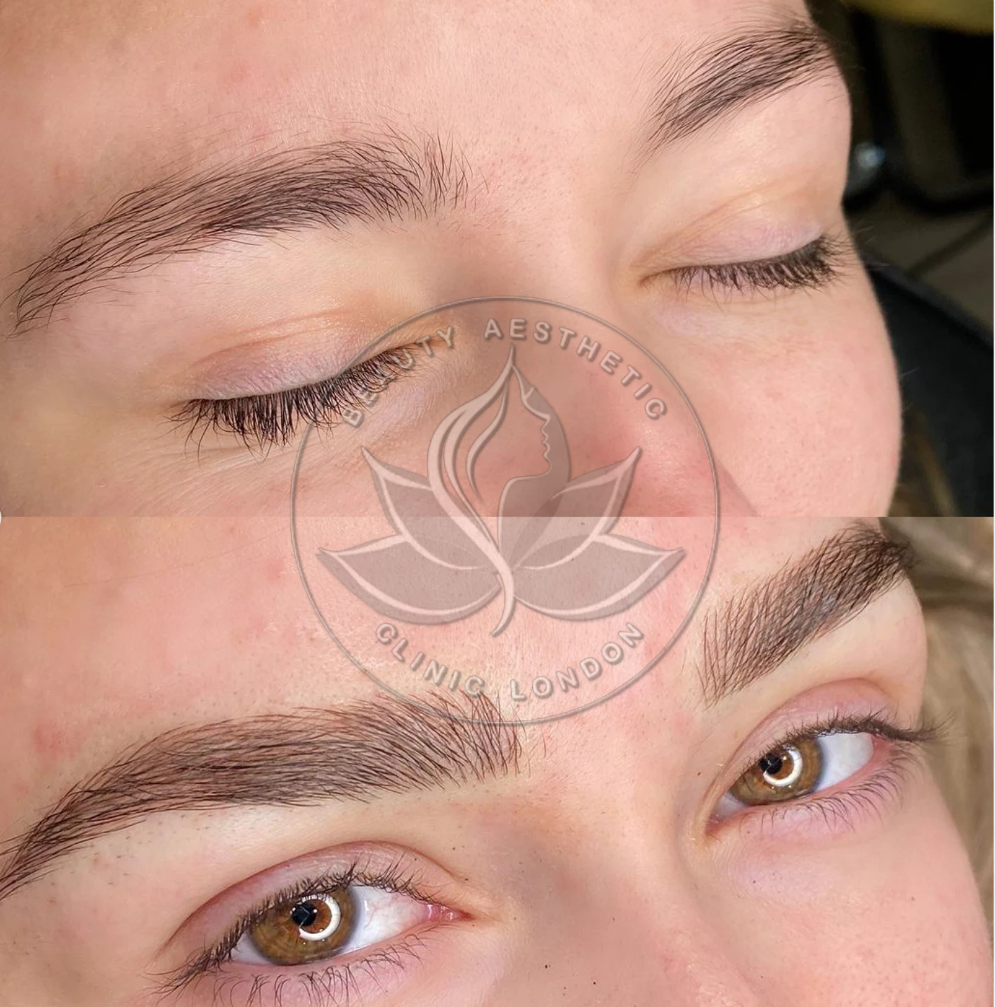 Beauty Aesthetic Clinic treatment result 19