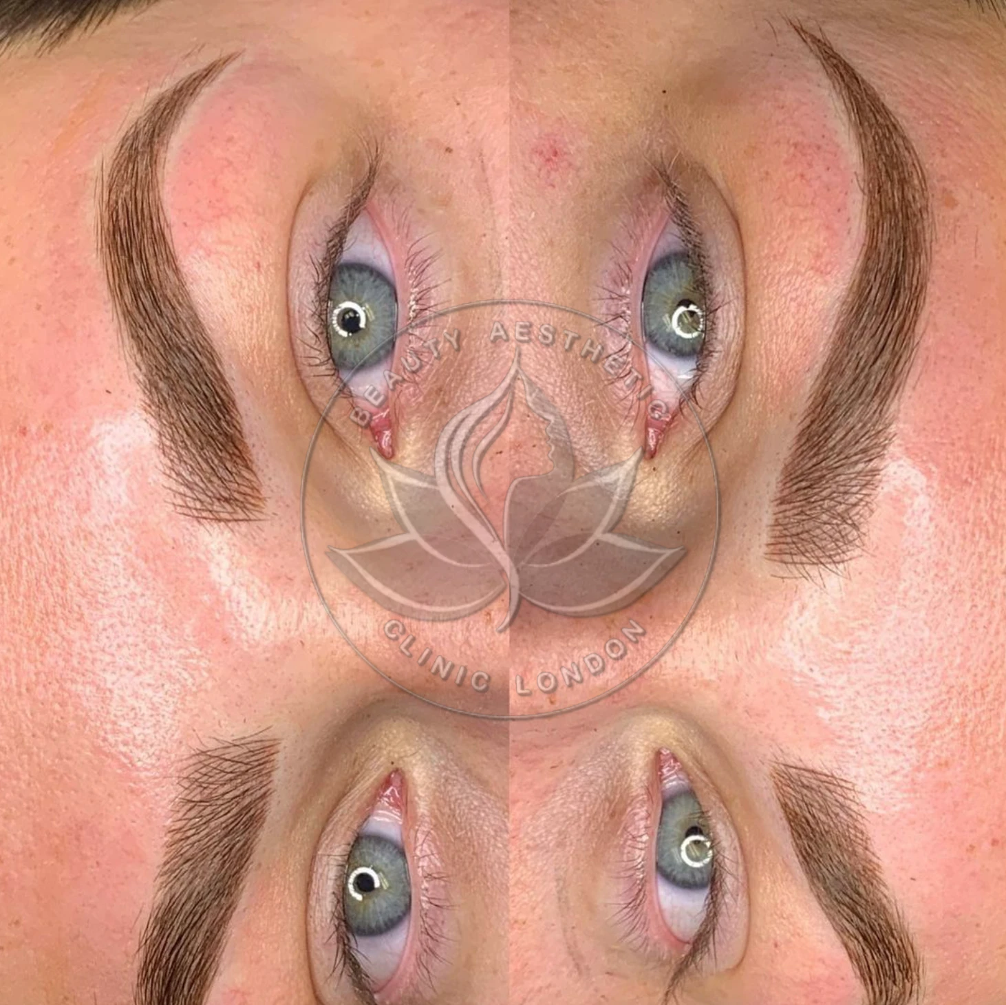 Beauty Aesthetic Clinic treatment result 12