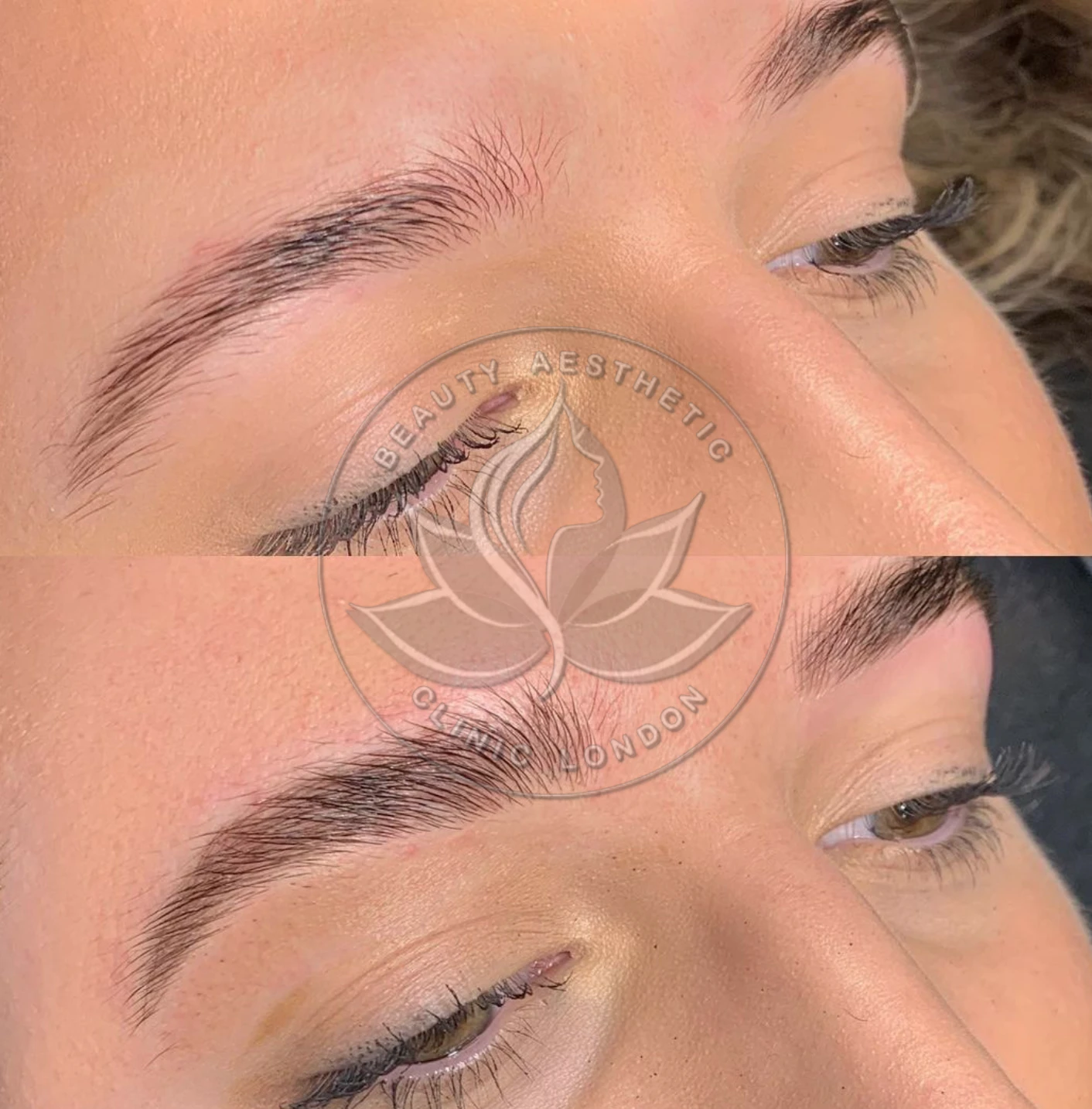 Beauty Aesthetic Clinic treatment result 11