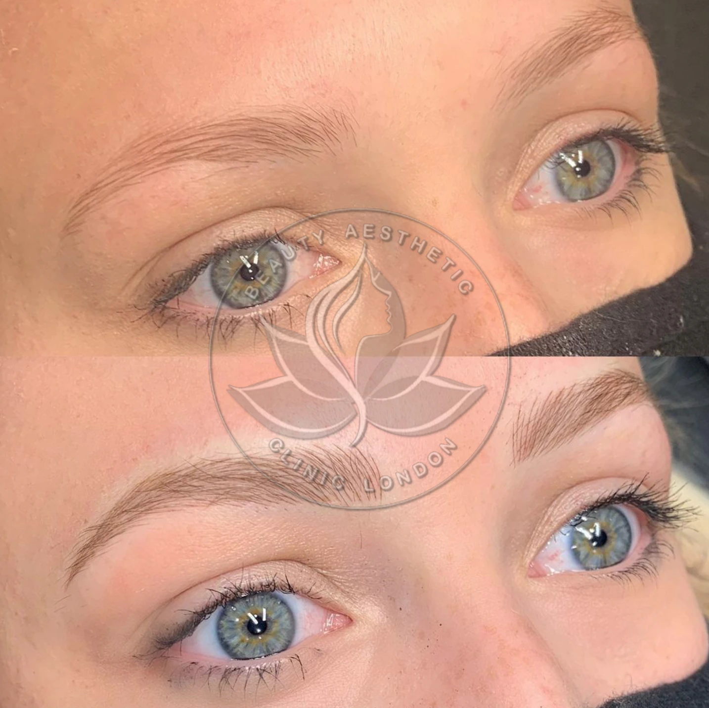 Beauty Aesthetic Clinic treatment result 4