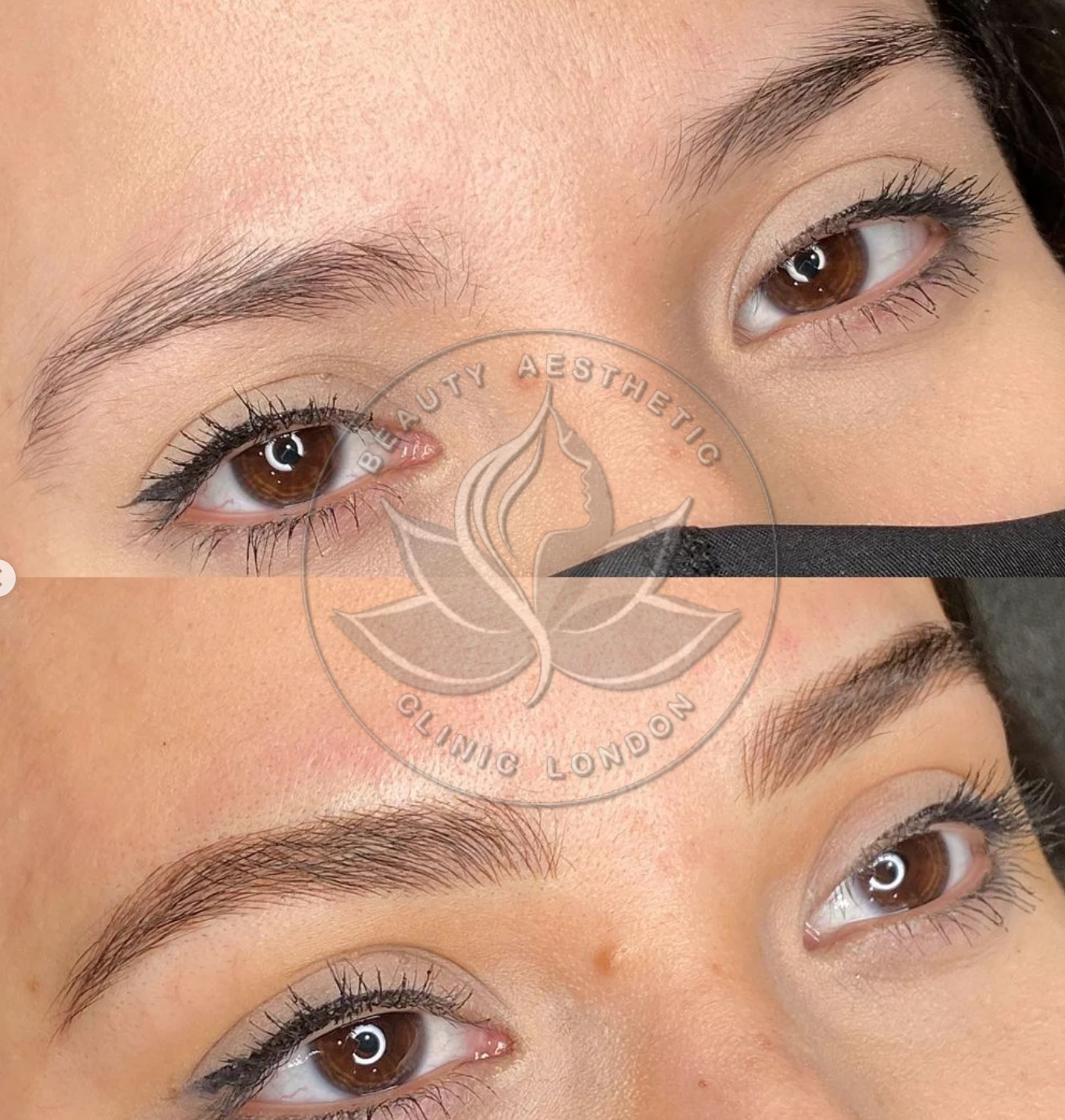 Beauty Aesthetic Clinic treatment result 1