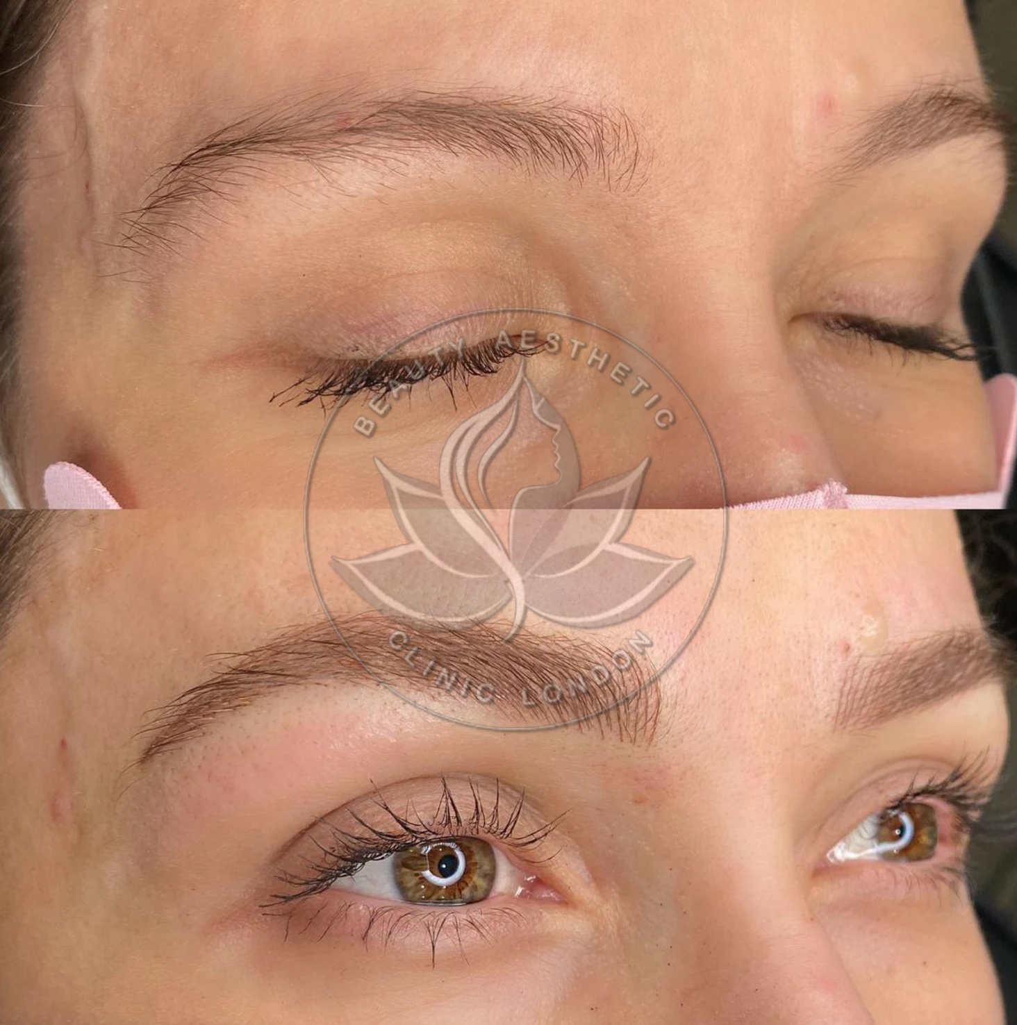 Beauty Aesthetic Clinic treatment result 7