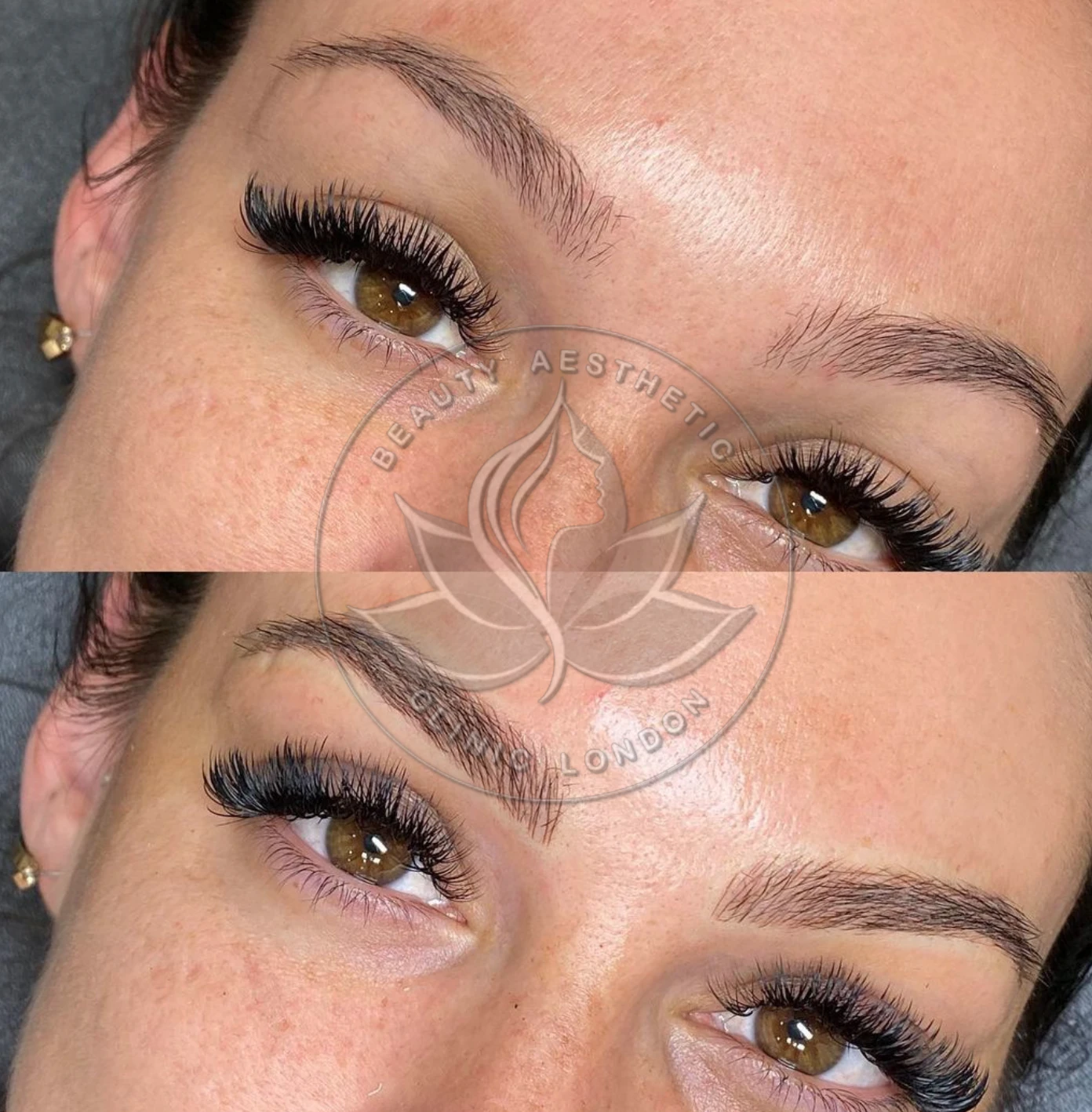 Beauty Aesthetic Clinic treatment result 2