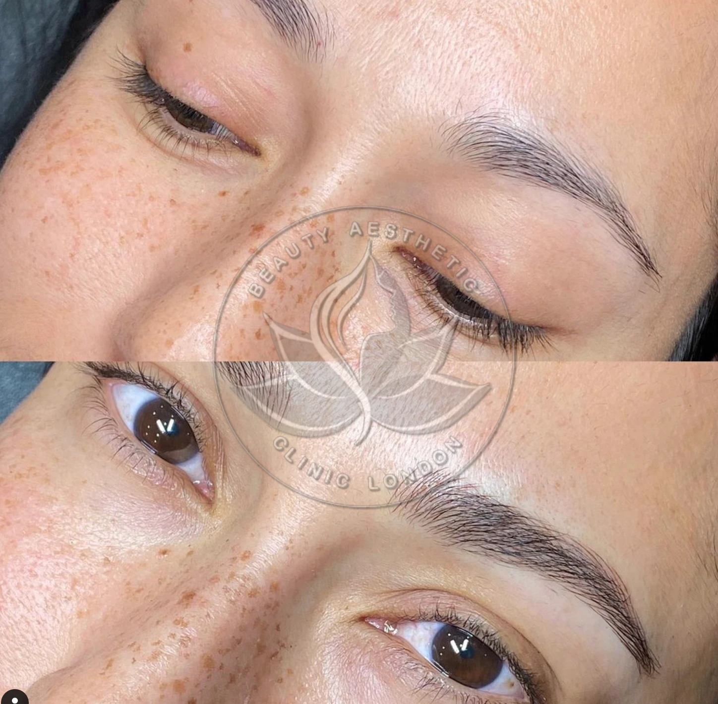 Beauty Aesthetic Clinic treatment result 17