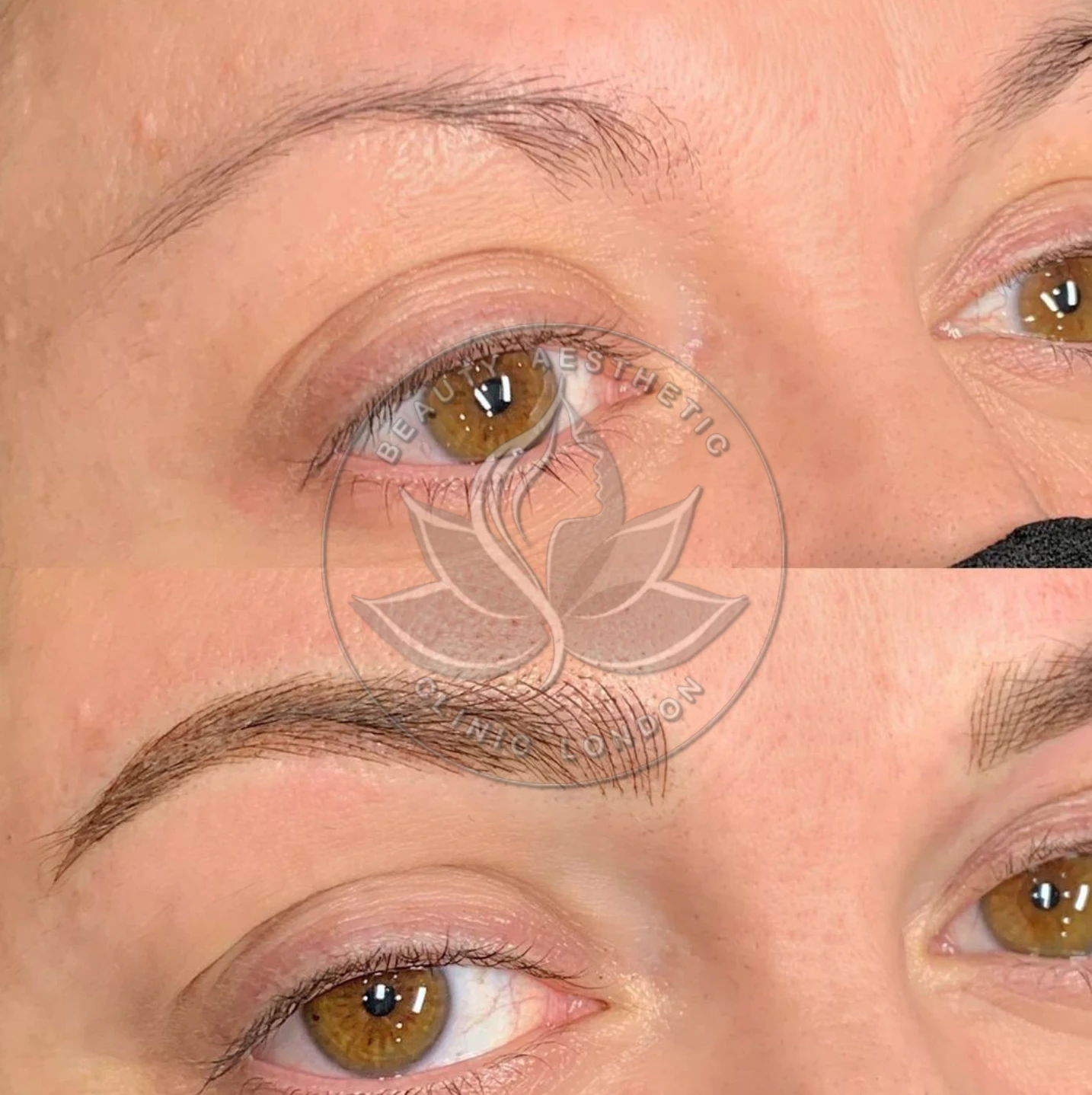 Beauty Aesthetic Clinic treatment result 10
