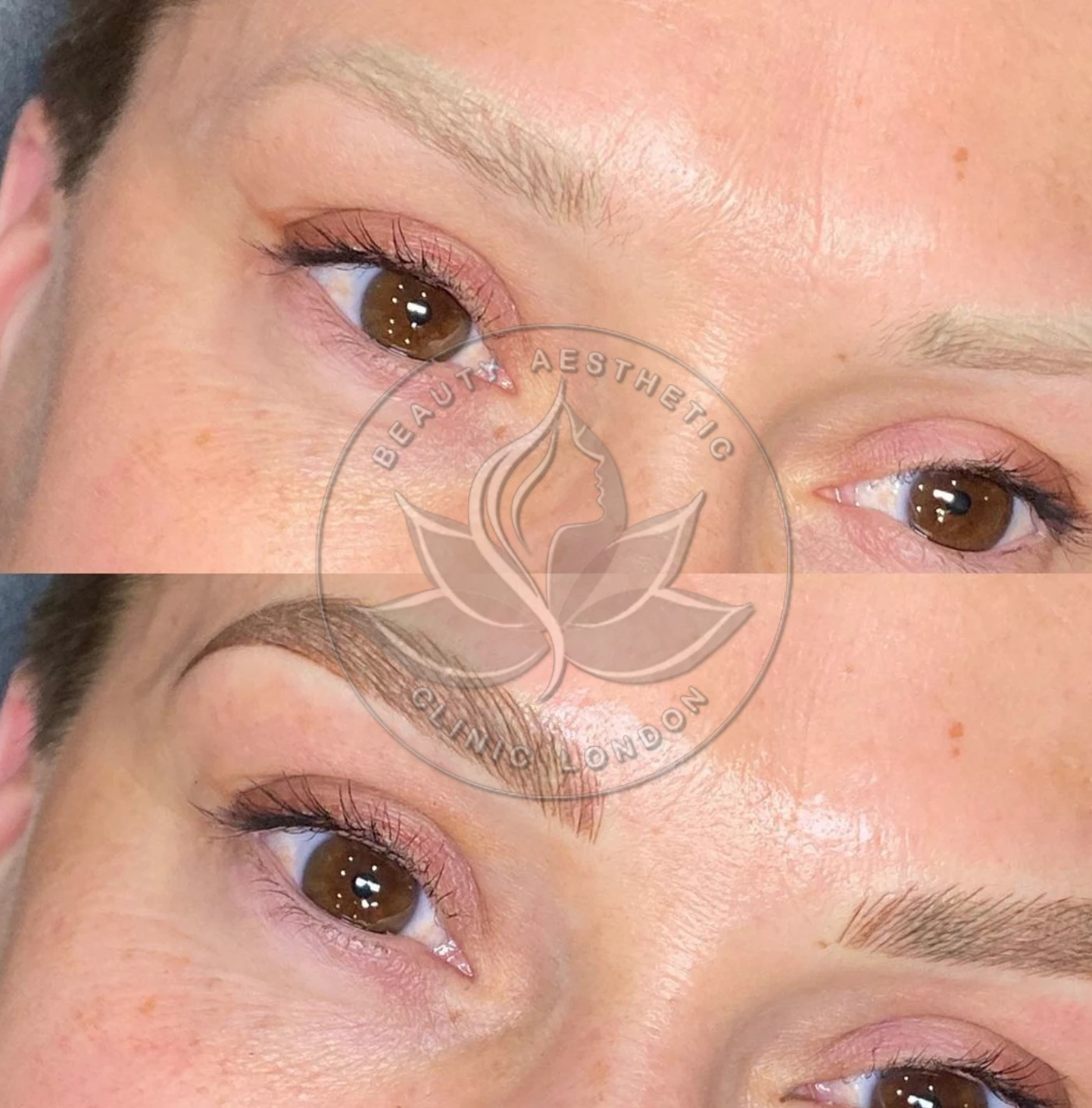 Beauty Aesthetic Clinic treatment result 9