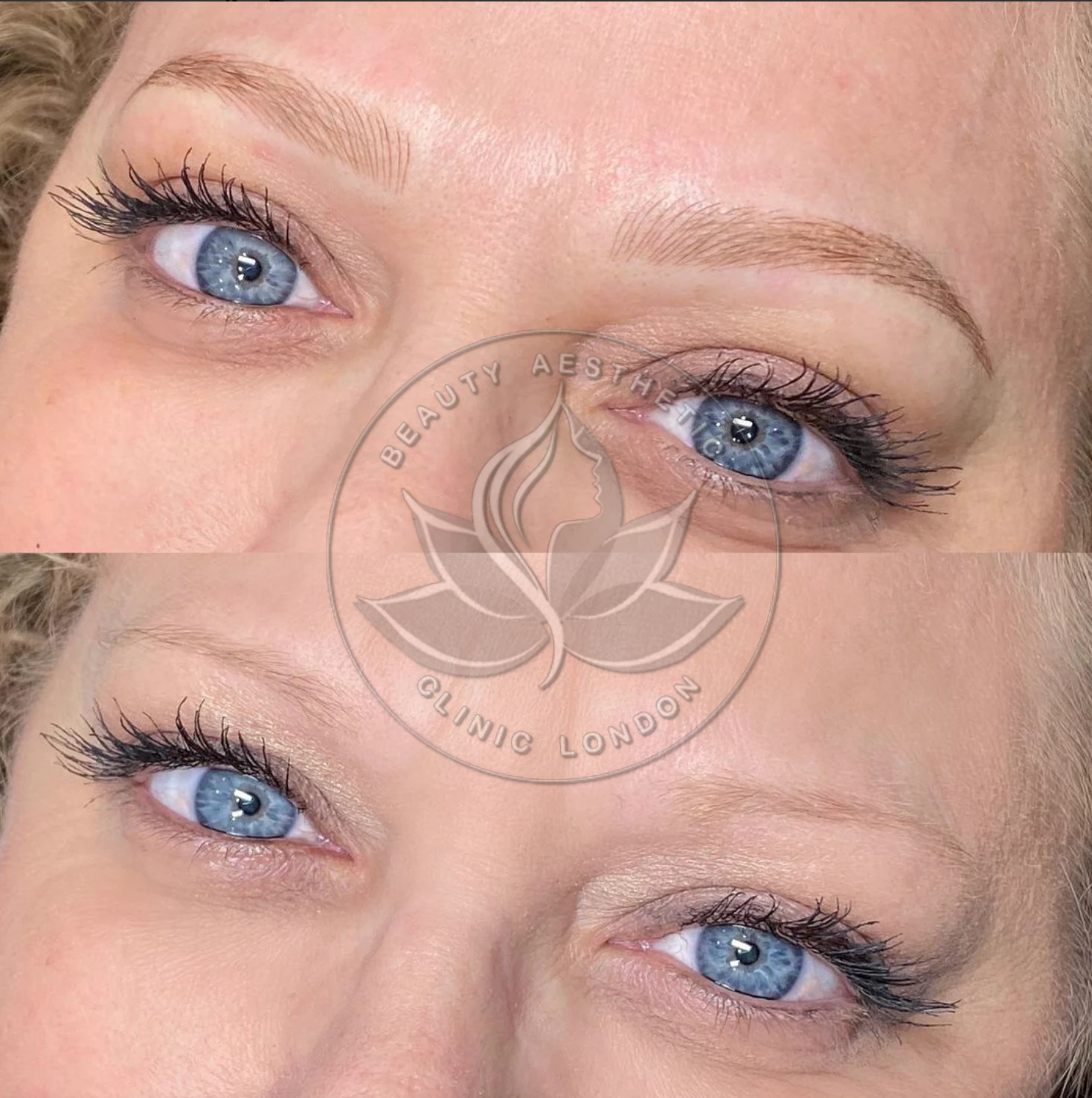 Beauty Aesthetic Clinic treatment result 3