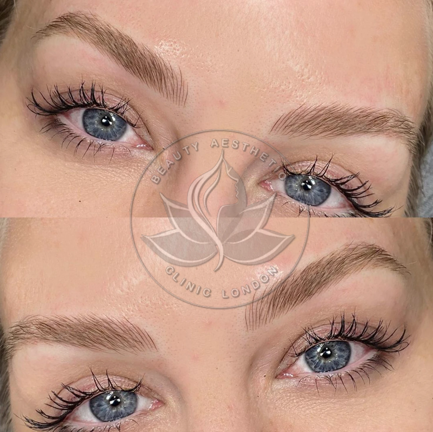 Beauty Aesthetic Clinic treatment result 16
