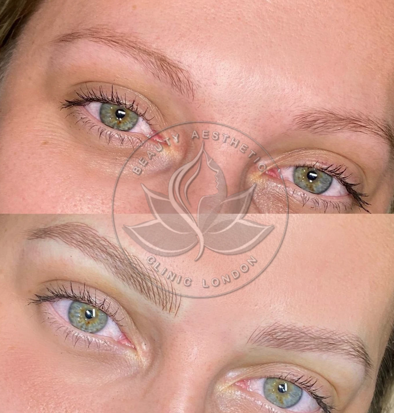 Beauty Aesthetic Clinic treatment result 8