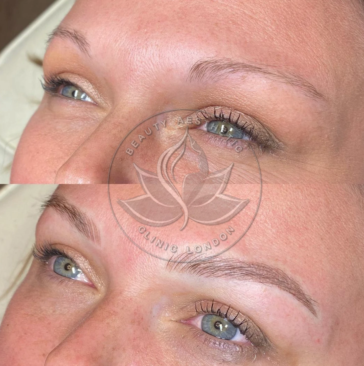 Beauty Aesthetic Clinic treatment result 6