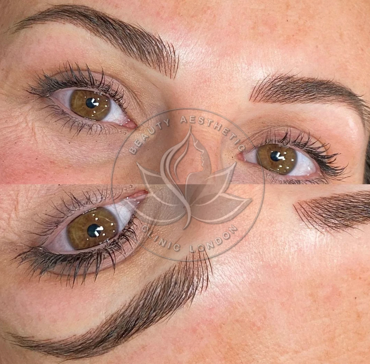 Beauty Aesthetic Clinic treatment result 15