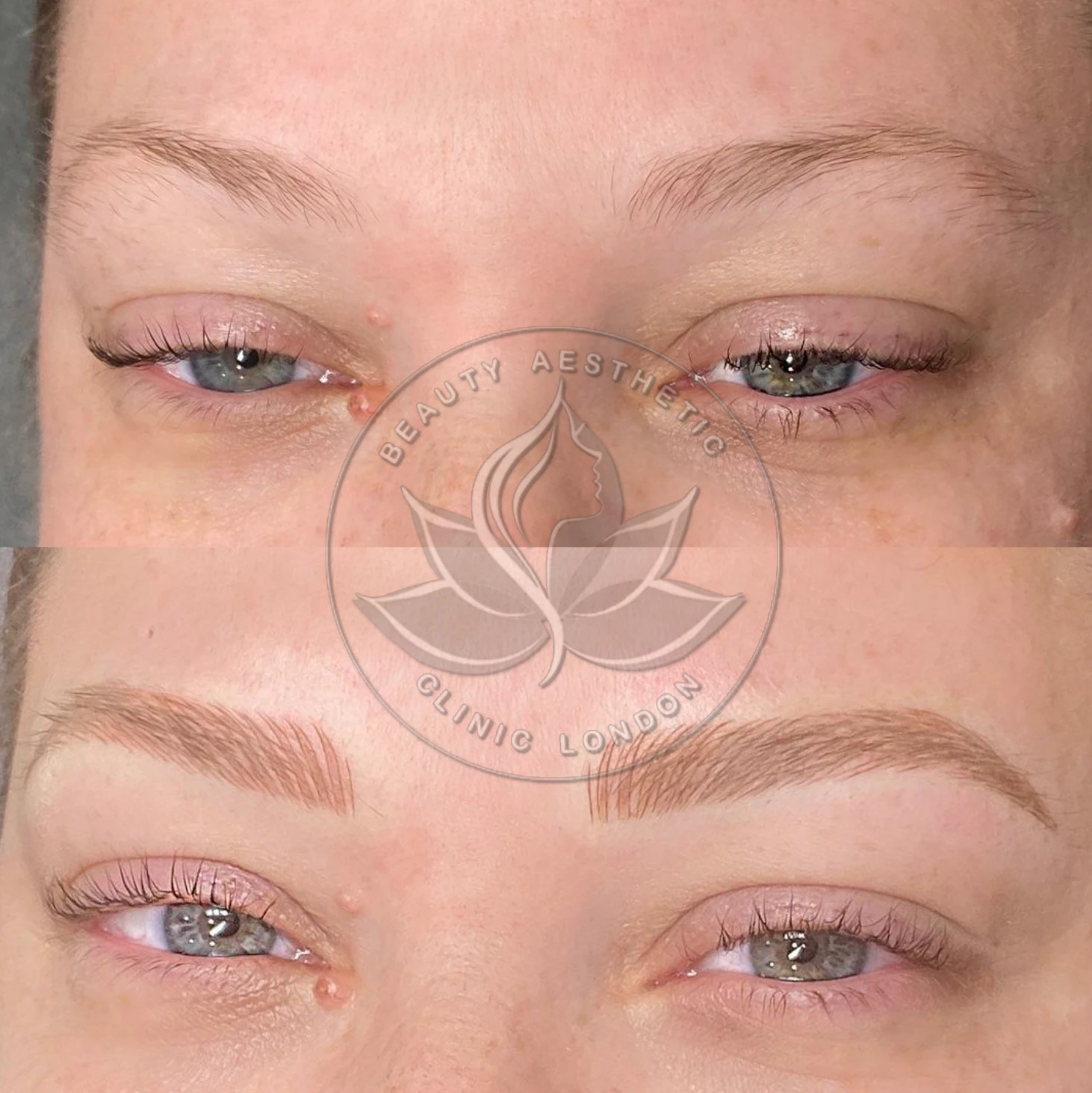 Beauty Aesthetic Clinic treatment result 14