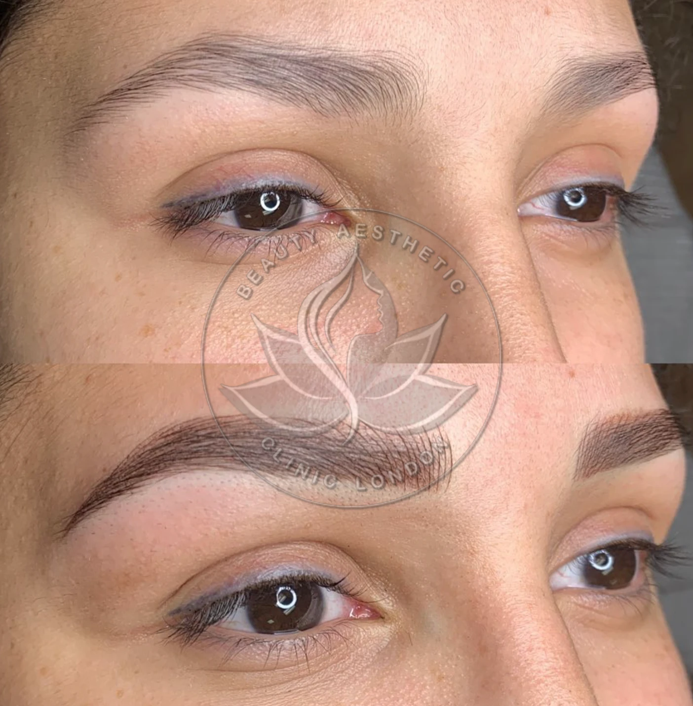Beauty Aesthetic Clinic treatment result 5