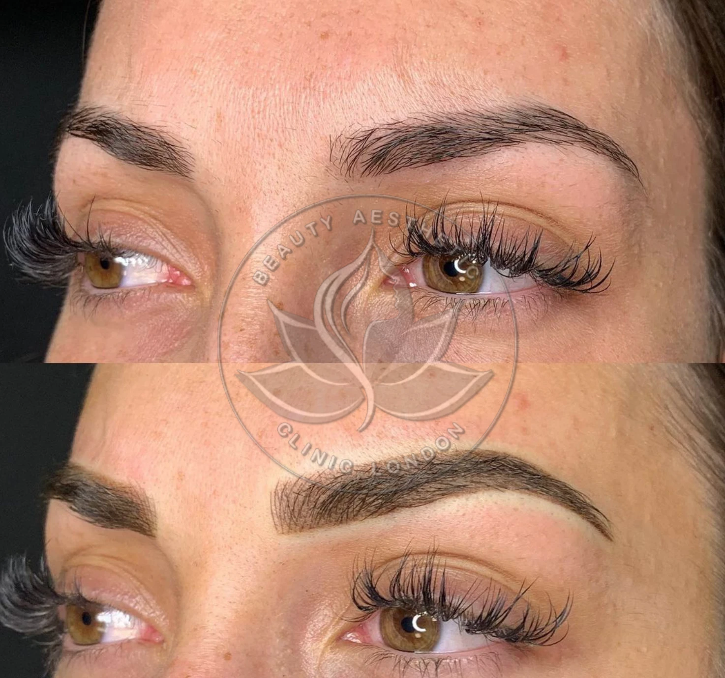 Beauty Aesthetic Clinic treatment result 13